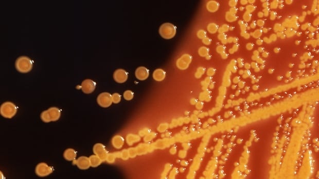 AHS details cockroaches, previous violations at kitchen used by Calgary daycares affected by E. coli outbreak-صحيفة الصوت