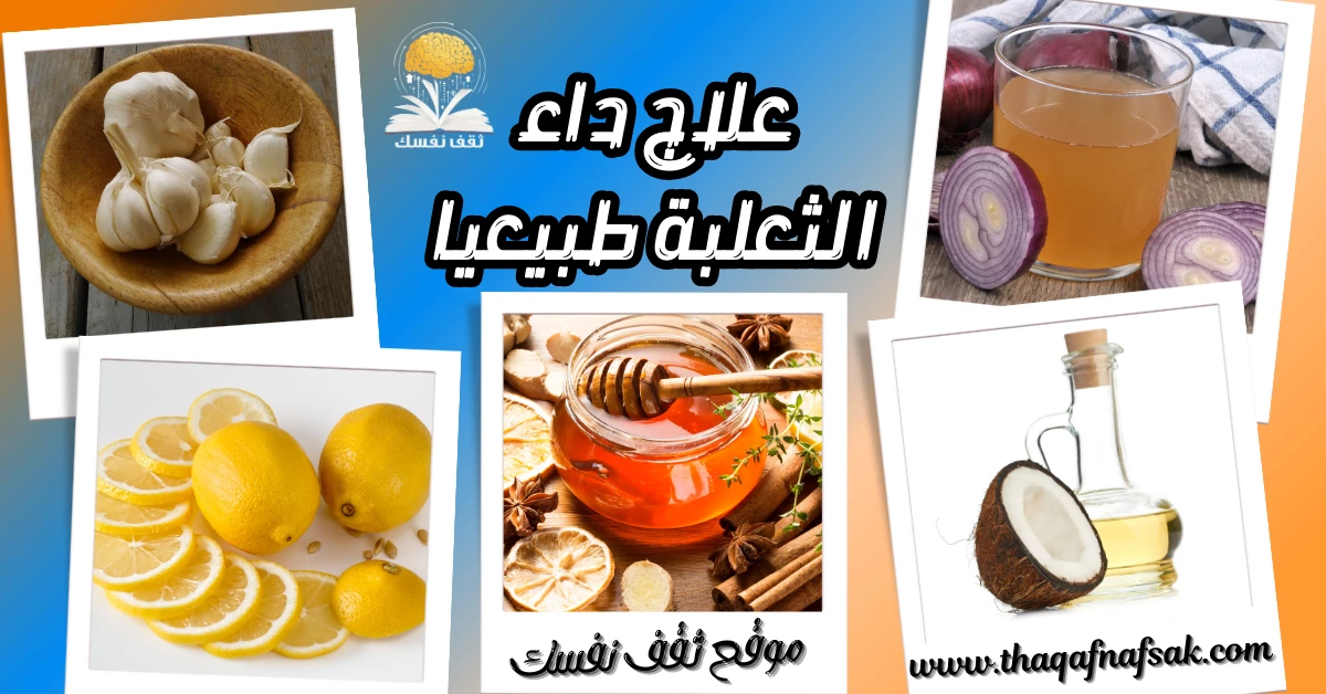 علاج داء الثعلبة طبيعيا أقوى 15 وصفة تُخلصك منه نهائيا – صحيفة الصوت