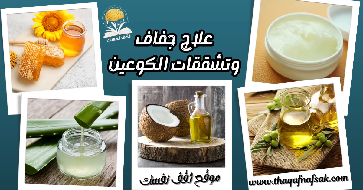 10 طرق طبيعية للتخلص من جفاف وتشققات الكوعين لا تفوتيها – صحيفة الصوت